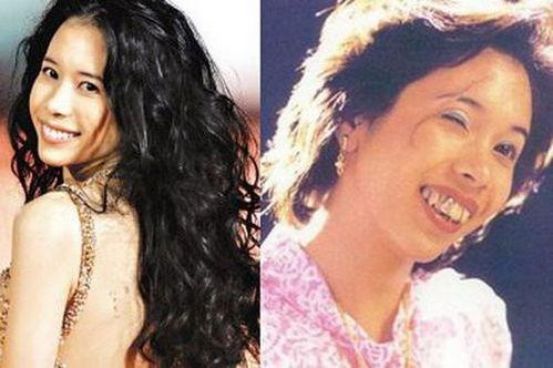 明星毁容前后照片,毁容前后照片揭示惊人变化